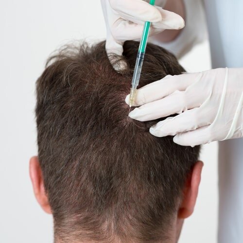 Wirkstoffbehandlung für Kopfhaut und Haare