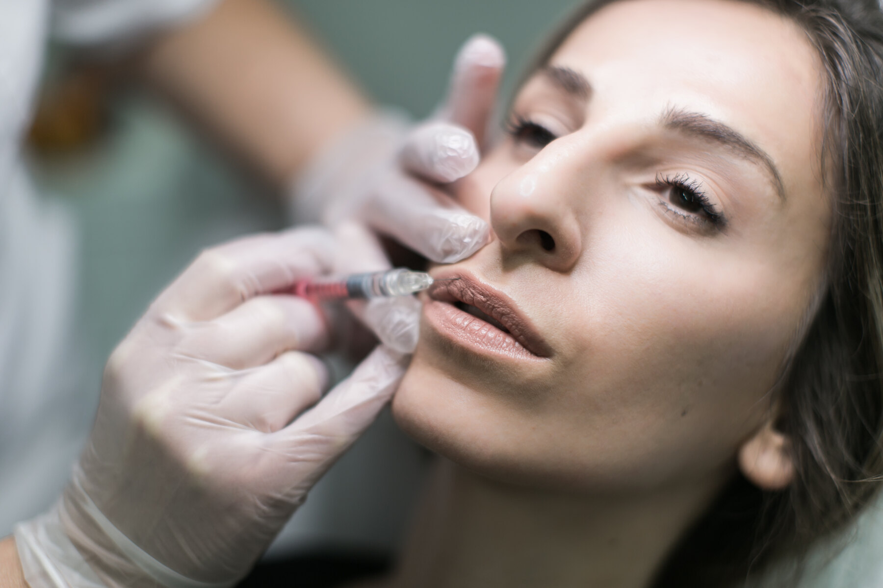 Hyaluronbehandlung für Lippen und Falten